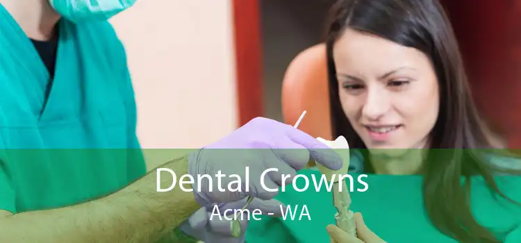 Dental Crowns Acme - WA