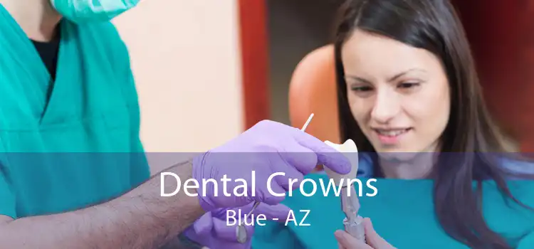 Dental Crowns Blue - AZ