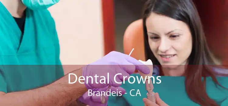 Dental Crowns Brandeis - CA