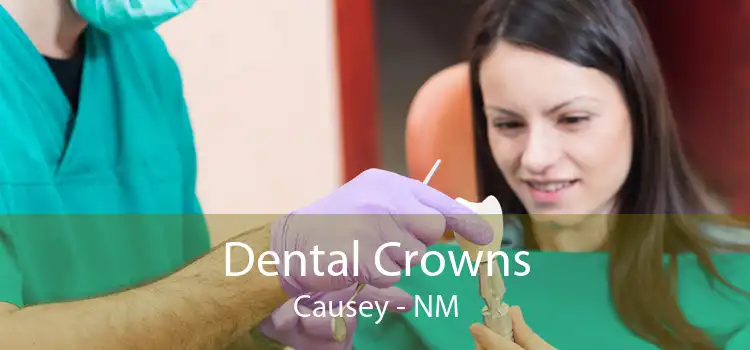 Dental Crowns Causey - NM