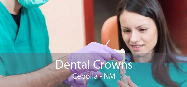 Dental Crowns Cebolla - NM