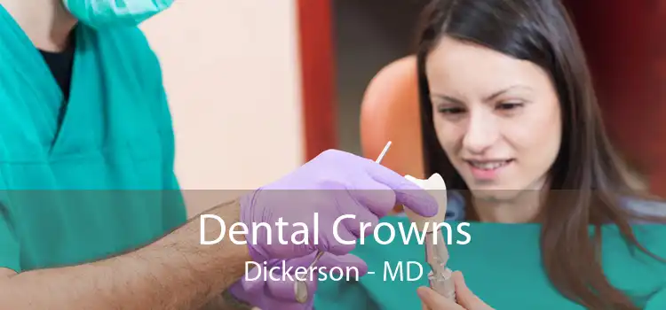 Dental Crowns Dickerson - MD