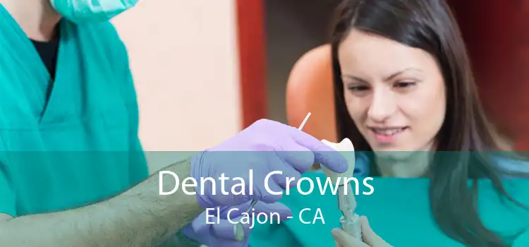 Dental Crowns El Cajon - CA