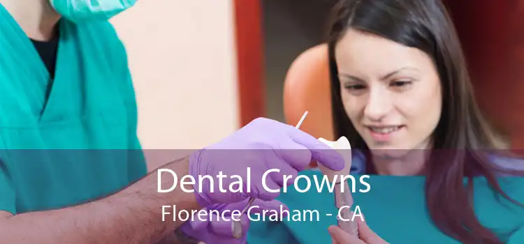 Dental Crowns Florence Graham - CA