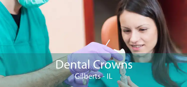 Dental Crowns Gilberts - IL