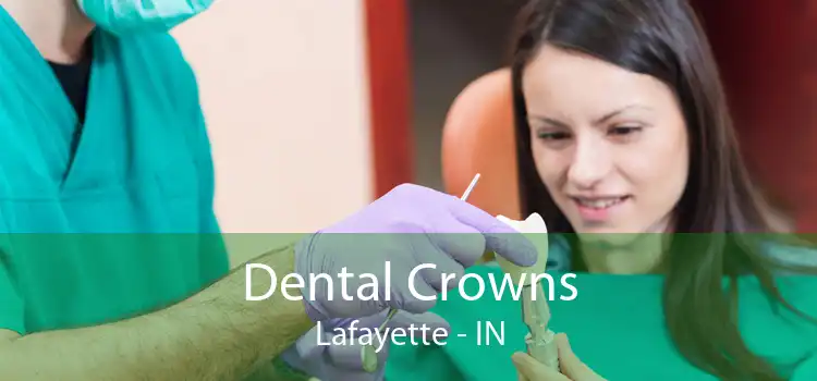Dental Crowns Lafayette - IN