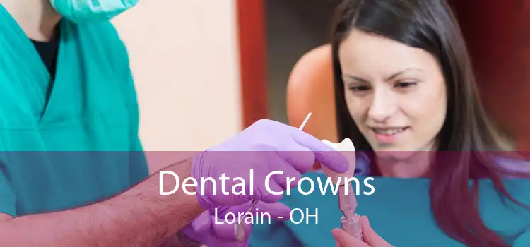 Dental Crowns Lorain - OH