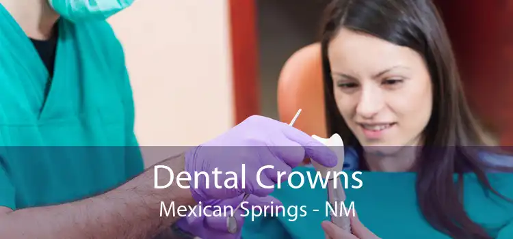Dental Crowns Mexican Springs - NM