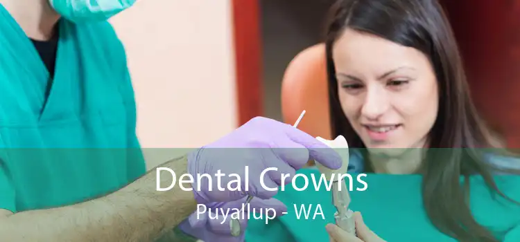 Dental Crowns Puyallup - WA