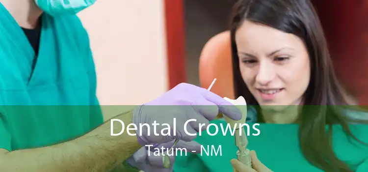 Dental Crowns Tatum - NM