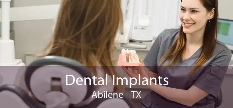 Dental Implants Abilene - TX