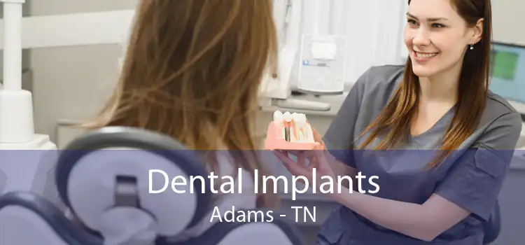 Dental Implants Adams - TN