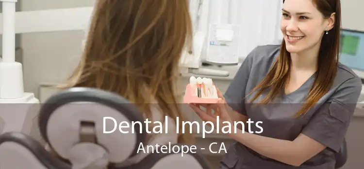 Dental Implants Antelope - CA