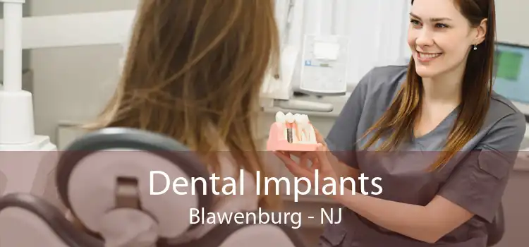 Dental Implants Blawenburg - NJ