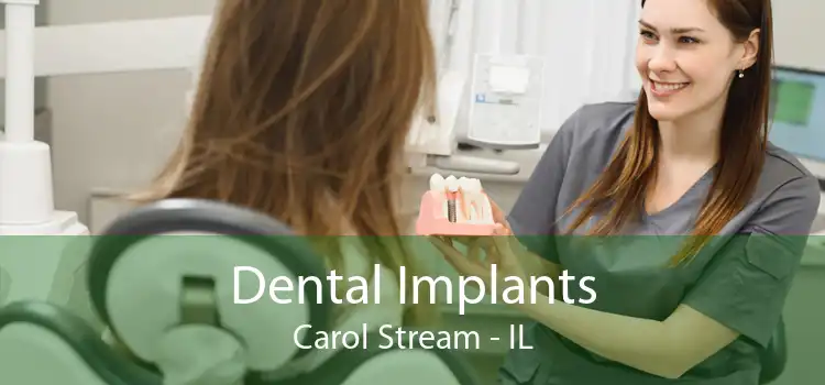 Dental Implants Carol Stream - IL