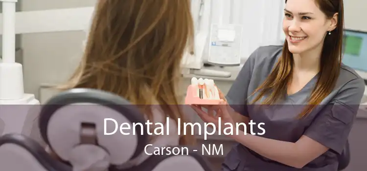 Dental Implants Carson - NM