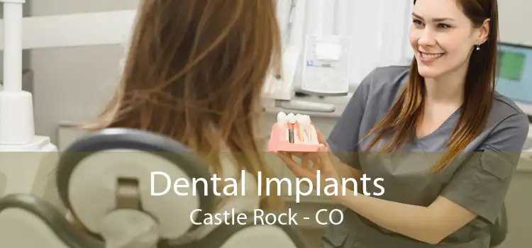 Dental Implants Castle Rock - CO