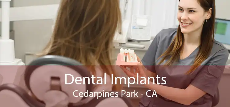 Dental Implants Cedarpines Park - CA