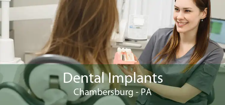 Dental Implants Chambersburg - PA