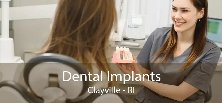 Dental Implants Clayville - RI