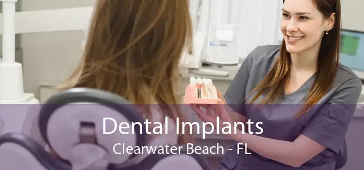 Dental Implants Clearwater Beach - FL