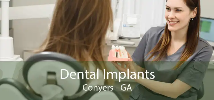 Dental Implants Conyers - GA