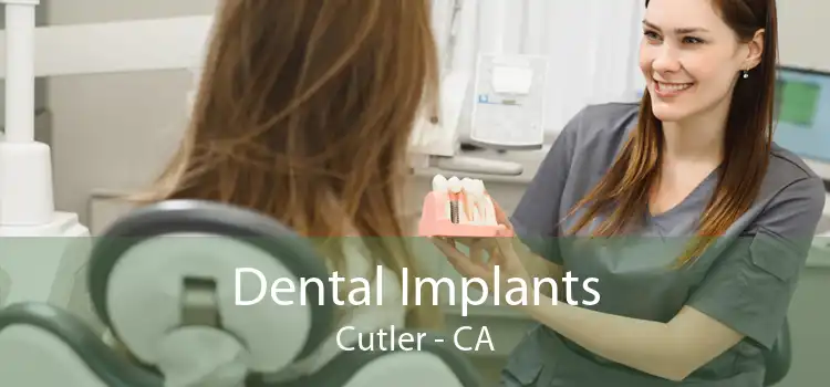 Dental Implants Cutler - CA