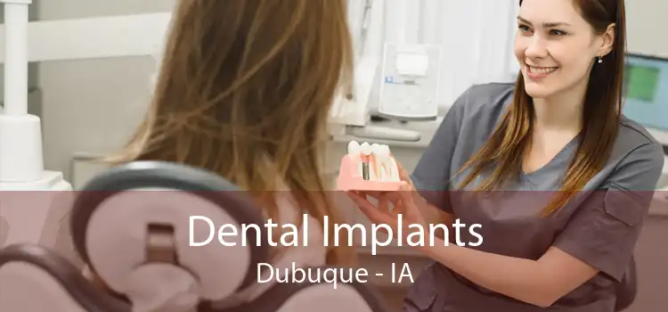 Dental Implants Dubuque - IA