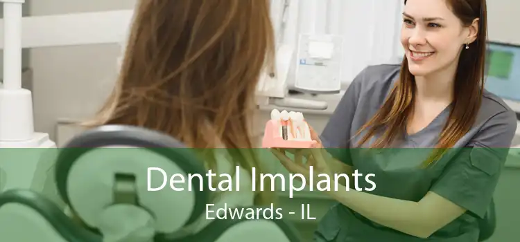 Dental Implants Edwards - IL