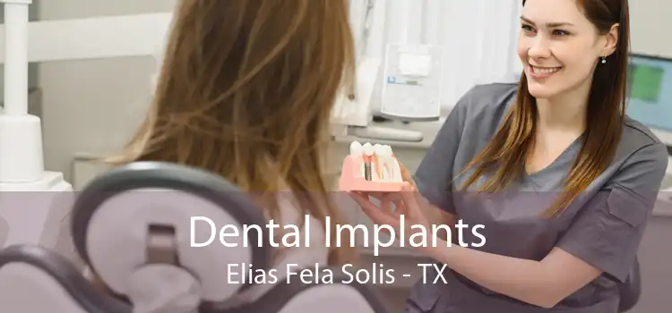 Dental Implants Elias Fela Solis - TX