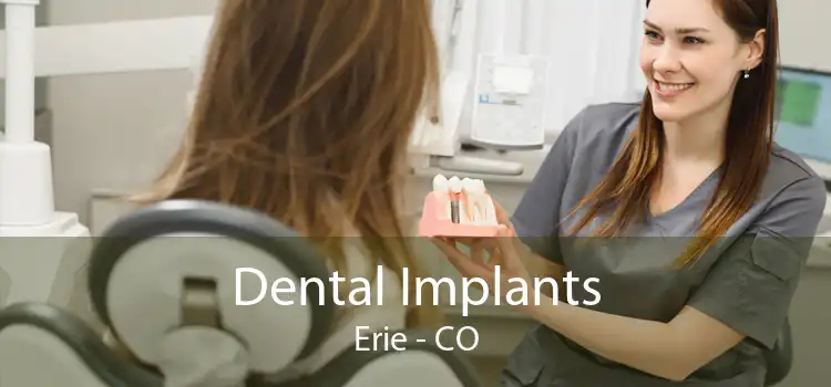 Dental Implants Erie - CO