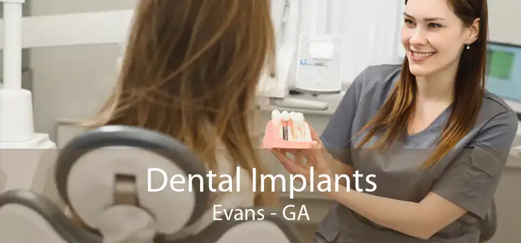 Dental Implants Evans - GA