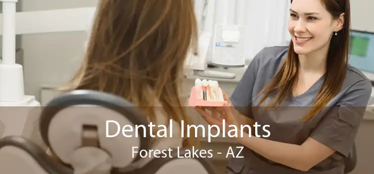 Dental Implants Forest Lakes - AZ