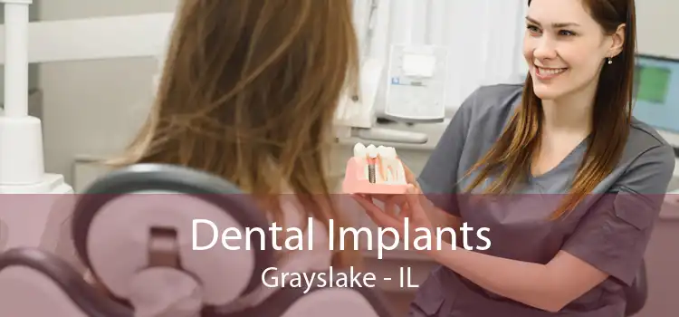 Dental Implants Grayslake - IL