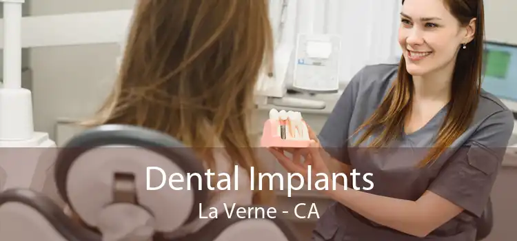 Dental Implants La Verne - CA