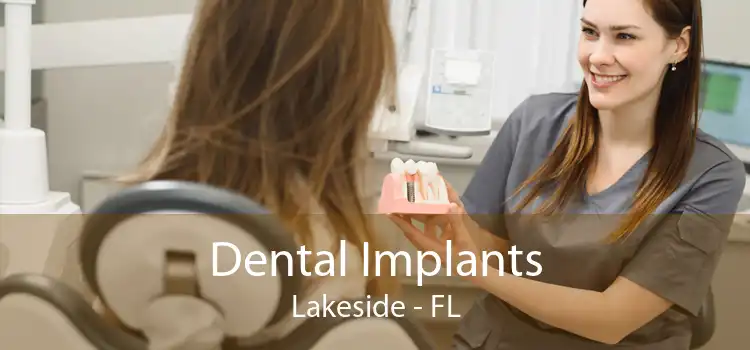 Dental Implants Lakeside - FL