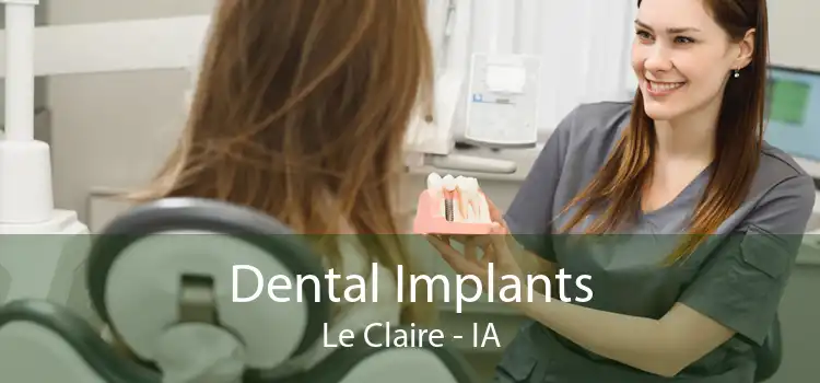 Dental Implants Le Claire - IA