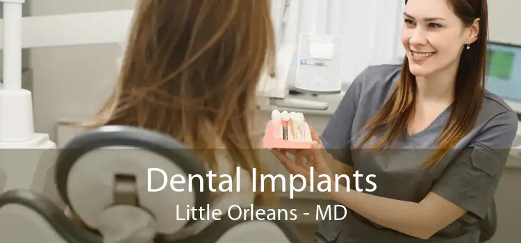 Dental Implants Little Orleans - MD