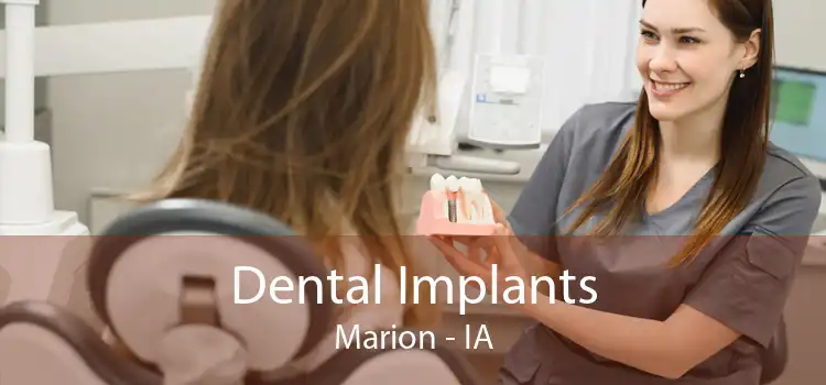 Dental Implants Marion - IA