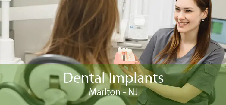 Dental Implants Marlton - NJ