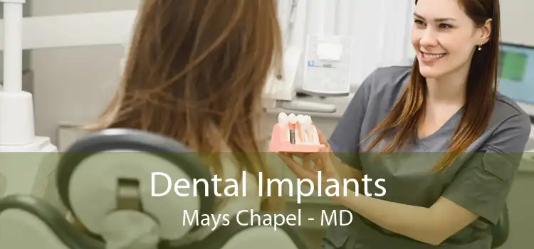 Dental Implants Mays Chapel - MD