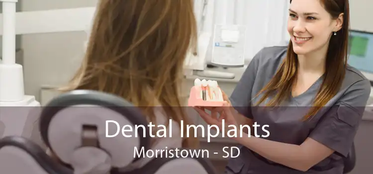 Dental Implants Morristown - SD