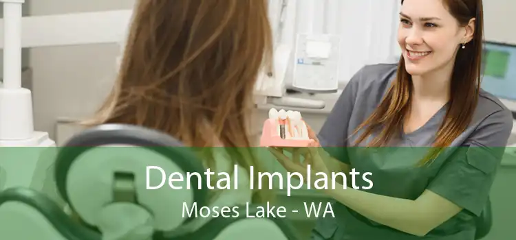 Dental Implants Moses Lake - WA