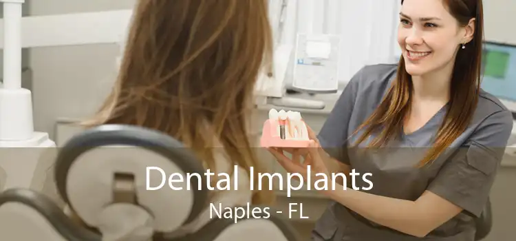 Dental Implants Naples - FL