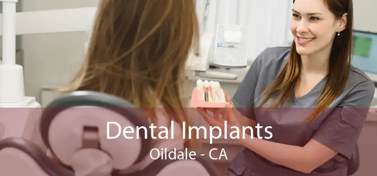 Dental Implants Oildale - CA