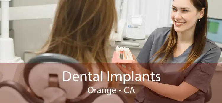Dental Implants Orange - CA