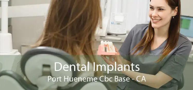 Dental Implants Port Hueneme Cbc Base - CA
