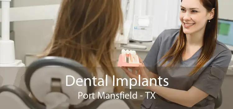 Dental Implants Port Mansfield - TX