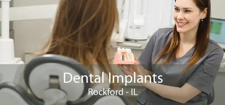 Dental Implants Rockford - IL