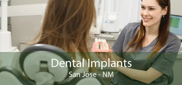 Dental Implants San Jose - NM